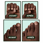 Charger l'image dans la galerie, Appareil OnyCure Pro™ - Retrouvez des ongles sains sans traitement compliqué